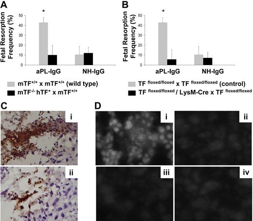 Figure 6. TF expression by myeloid cells but not fetal-derived cells contributes to aPL-induced fetal loss. (A) Low TF female mice (mTF−/−,hTF+) mated with wild-type males (mTF+/+) and wild-type female mice mated with wild-type males (mTF+/+ × mTF+/+) were treated on days 8 and 12 with aPL-IgG or NH-IgG. On day 15, fetal resorption rates were calculated as described 19in “Materials and methods, Murine aPL-induced fetal loss model.” Approximately 40% of the embryos in wild-type matings treated with aPL-IgG were resorbed. Low TF female mice mated with wild-type males showed a reduction in aPL-induced fetal resorption frequency compared with wild-type mice (P < .005). Error bars here and in panel B are SD. (B) Pregnant TFfloxed/floxed and TFfloxed/floxed/LysM-Cre mice were treated with aPL-IgG or NH-IgG on days 8 and 12 of pregnancy. Fetal resorption frequency was calculated as described19 in “Materials and methods, Murine aPL-induced fetal loss model.” Treatment with aPL-IgG caused an increase in fetal resorptions in TFfloxed/floxed mice (*P < .001 versus NH-IgG). TFfloxed/floxed/LysM-Cre mice were protected from fetal loss induced by aPL-IgG. Fetal resorption frequency in these mice was comparable with TFfloxed/floxed mice treated with NH-IgG. (C) Immunohistochemical analysis for neutrophils in sections of deciduas from aPL-IgG–treated mice. Intense staining for neutrophils (brown color) was observed in deciduas from TFfloxed/floxed mice treated with aPL-IgG (Ci). In contrast, less neutrophil infiltration was observed in deciduas from TFfloxed/floxed/LysMCre mice that had received aPL-IgG (Cii). Counterstain: hematoxylin. Original magnification × 500. (D) Superoxide (O2−) generation in decidual tissue was determined using dihydroethidium fluorescence. aPL-induced O2− formation (Di) is attenuated in TFfloxed/floxed/LysM-Cre mice (Dii) and low TF mice (Diii) to a similar extent to NH-IgG–treated mice (Div). Original magnification × 800.