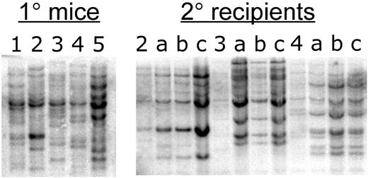 Figure 3. Southern-blot analysis of bcCML. Bone marrow DNA from 5 primary recipient mice (left panel) was digested with EcoRI and hybridized with a GFP probe, which detects bands of unique size for each independent viral integrant. For primary animals nos. 2, 3, and 4, 3 secondary recipients (a, b, and c) were established. The right panel shows EcoRI digestion and GFP probe analysis of the secondary recipients in comparison to each primary donor.