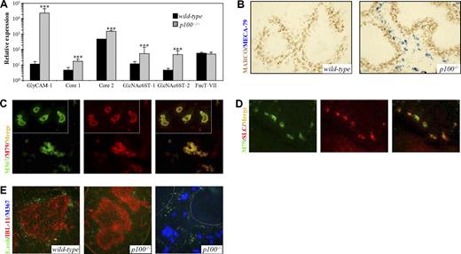 Figure 7. Lack of p100 results in the induction of ectopic HEV-like structures in the splenic red pulp. (A) QRT-PCR analysis of GlyCAM-1, β3GlcNAcT-3 (core 1), Core2GlcNAcT-I (core 2), GlcNAc6ST-1, GlcNAc6ST-2, and FucT-VII in spleens from wild-type and p100−/− mice. Note the log scale of relative mRNA expression. Error bars are SD. Significant differences are indicated (Student t test, ***P < .002). (B) Immunohistochemical staining of wild-type and p100−/− spleen sections for MZMs (anti-MARCO; DAB brown) and MECA-79 (Vector Blue). (C) 2-color immunofluorescence of p100−/− spleen sections stained with MECA-367 (M367; FITC green) and MECA-79 mAbs (M79; Texas red). Most MECA-367+ structures exhibited coexpression of PNAd (merge; yellow fluorescence). Insets, mesenteric LN HEVs from p100−/− mice. (D) 2-color immunofluorescence of p100−/− spleen sections stained with MECA-79 (M79; FITC green) and anti-CCL21 (SLC; Texas red). Most MECA-79+ structures exhibited coexpression of CCL21 (merge; yellow fluorescence). (E) Spleen sections from p100−/− mice (middle panel) and control littermates (left panel) that were intravenously injected with FITC-labeled E. coli were stained with the IBL-11 mAb (red) to indicate the white pulp. The right panel shows FITC-E. coli in p100−/− spleen sections stained with MECA-367 (Vector Blue) to indicate ectopic HEV-like structures. Dotted lines mark the boundary of the white pulp. Images were acquired as in Figure 2E, with 20×/0.70 objective (B), 40×/0.75 objective (C,D); 20×/0.70 objective (panel E left and middle), 40×/0.75 objective (panel E right).