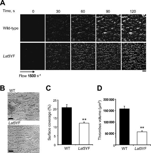Figure 2. Mutation of the 3 C-terminal tyrosines of LAT affect platelet thrombi formation on collagen under flow. DiOC6-labeled platelets in whole blood were perfused through a collagen-coated microcapillary at a shear rate of 1500 s−1 for 2 minutes. (A) Thrombus formation was visualized with a 40×/1.3 NA; long working distance objective in real time and then imaged using transmitted light microscopy. (B) After a washing step with phosphate-buffered saline for 2 minutes at the same shear rate to remove nonadherent cells, slides were visualized using differential interference contrast microscopy. Representative images of platelet adhesion from WT and Lat3YF mice are shown. A representative time course for both WT (top panel) and Lat3YF (bottom panel) platelet accumulation on collagen is shown (see “In vitro flow-based adhesion studies” for complete image acquisition information). (C) Area covered by platelet thrombi and (D) thrombus volume were measured at 2 surface locations in each of 3 different experiments (mean ± SEM). **P < .005 versus WT, according to Student t test. Scale bar equals 20 μm.
