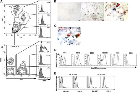 Figure 5. NK cells colocalize with monocytes and DCs in the RA synovium and induce differentiation of CD14+ monocytes into DCNK in vitro. (A) 15A11 staining pattern on cells isolated from SF of a patient with RA. The 3 gates (ie, R1, R2, and R3) set based on FSC and SSC profiles shown on the top contour plot, and the corresponding top 3 normalized histogram overlay plots show that 15A11 primarily detects cells within a lymphocyte gated (ie R1) population. The bottom contour plot shows CD56 and CD3 expression on cells gated on SF lymphocytes (ie R1), and the corresponding 3 normalized histogram overlay plots show that 15A11 binds to 51% of SF-NK cells (CD3−CD56+), whereas it shows minimal binding to SF-T cells (CD3+), or to CD3−CD56− SF cells. In each histogram, the bold line indicates 15A11 staining, and the filled gray histogram indicates IgM-isotype control staining gated on respective population. An equal number of cells were used for staining with isotype and 15A11 versus CD3 and CD56. (B) The middle panel shows double staining of RA synovium using 15A11 mAb and anti-CD14 mAb. Red arrowheads indicate areas where NK cells (blue) and monocytes (red) are found in close apposition. The bar equals 50 μm. The right panel shows a higher magnification of the area marked with an asterisk in the central panel. The left panel shows staining of an adjacent RA section using isotype control antibodies. (C) Cell contact between NK cells and DCs in inflamed synovial tissue of a representative RA patient. Double staining using 15A11 mAb shows colocalization of 2 NK cells (red) with a DC-LAMP+ DC (brown). The tissue section has been counterstained with hematoxylin (blue) and the bar equals 50 μm. (D) CD14+ monocytes were cultured alone (- - -) or together with IL-15–stimulated SF NK cells (–). Cells were stained on day 3 for surface expression of CD14, CD86, CD80, DC-SIGN, CD40, and CD83 as indicated. DCs are gated based on their FSC:SSC profiles, and NK cells are excluded by gating on CD56+ cells. The filled gray histograms represent the isotype control staining. In each normalized histogram overlay, an equal number of cells were used for staining with isotype versus specific mAb. (E) NK-cell surface expression of GM-CSF and CD154 on PB CD56bright NK cells (left 2 panels) and SF NK cells (right 2 panels). NK cells maintained in IL-15 were stained with a mAb against human GM-CSF or CD154 (bold lines, as indicated) or with an isotype control Ab (filled gray histogram).