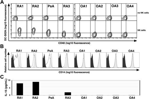 Figure 6. Synovial fluid derived from patients with RA and PsA, but not OA, induces monocyte differentiation into DCs in the presence of NK cells. (A) CD14+ PB monocytes derived from a healthy donor were cultured alone (top row) or together with freshly isolated autologous PB NK cells (bottom row) in medium containing 10% cell-free SF derived from patients with RA (n = 3), PsA (n = 1) or OA (n = 4) as indicated on the top. Cells were stained on day 4 for DC-SIGN and CD40. A combined gate was set on monocytes/DCs based on their CD56− and FSC:SSC profiles, and quadrants are set according to the isotype control staining. One of 2 experiments performed with similar results is shown. (B) The light gray histograms depict the CD14 levels on monocytes derived from healthy donors when cultured alone in the presence of medium supplemented with 10% cell-free SF from the patients in panel A, as indicated. The bold lines indicate the CD14 levels on cells cocultured with autologous NK cells in the presence of 10% SF as indicated. The black histogram indicates the isotype control staining of monocytes cultured in medium alone. (C) The IL-15 levels as measured by ELISA in cell-free SF derived from the patients in panel A as indicated.