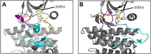 Figure 2. Structures of imatinib and dasatinib bound to Abl kinase. (A) View of imatinib (gold) in complex with the Abl kinase domain, in which the activation loop (cyan) is in the “closed” position and the ATP binding loop (magenta) is distorted downward relative to the ATP-bound state. (B) View of dasatinib (gold) in complex with the Abl kinase domain. The activation loop (cyan) is in the “open” position and the ATP binding loop is shown in magenta. In both panels, an arrow denotes the position of Abl residue threonine-315 (side chain in green). For both inhibitors, oxygen (red) and nitrogen (blue) atoms are highlighted.