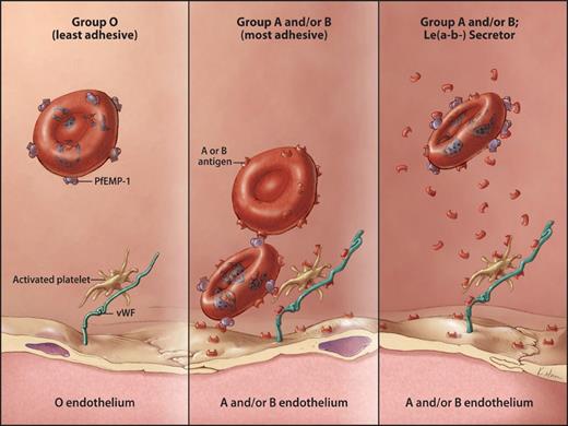 Figure 3. Hypothetical model for cytoadhesion of parasitized RBCs to blood group A or group B structures. Infected RBCs expressing PfEMP-1 can bind to group A (or to a lesser extent, group B) determinants on other cells. In the left panel, cytoadhesion from lectin-binding fails to occur because of the absence of group A or group B antigens. In the center panel, an infected RBC adheres to an uninfected RBC (homotypic adherence) via A or B antigens. The infected cell in turn adheres to endothelium either by binding to blood group antigen on endothelial cells or by binding to blood group antigens on platelets or VWF (heterotypic adherence). In the right panel, cytoadherence is blocked by soluble blood group substance present in the plasma of group A and/or B individuals with the Le(a−b−) Secretor phenotype. Copyright Kimberly Main Knoper; used with permission.