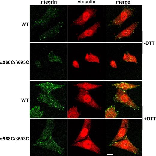 Figure 4. Recruitment of αIIbβ3 integrin at focal adhesion sites. Cells were allowed to adhere on immobilized fibrinogen (in the presence of 10 μg/mL mAb LM609) at 37°C for 1 hour in the presence or absence of 1 mM DTT, followed by fixation and staining with antivinculin and anti-αIIb mAb PT25–2 conjugated with Alexa Fluor 488 as described in “Cell spreading and microscopy.” The stained cells were subjected to confocal microscopy. Scale bar represents 10 μm.