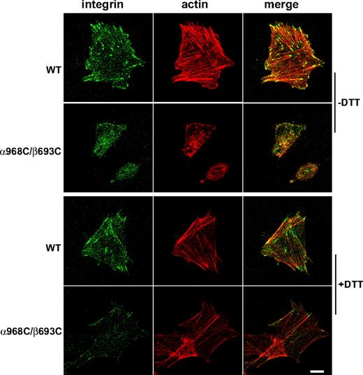 Figure 5. Actin stress-fiber formation in the stably transfected CHO-K1 cells adhering on immobilized fibrinogen. Cells were seeded on fibrinogen-coated surfaces (in the presence of 10 μg/mL mAb LM609) and incubated at 37°C for 1 hour in the presence or absence of 1 mM DTT. After fixation and permeabilization, the adhering cells were stained with phalloidin conjugated with Alexa Fluor 546 and anti-αIIb mAb PT25–2 conjugated with Alexa Fluor 488. The stained cells were subjected to confocal microscopy. Scale bar represents 10 μm.