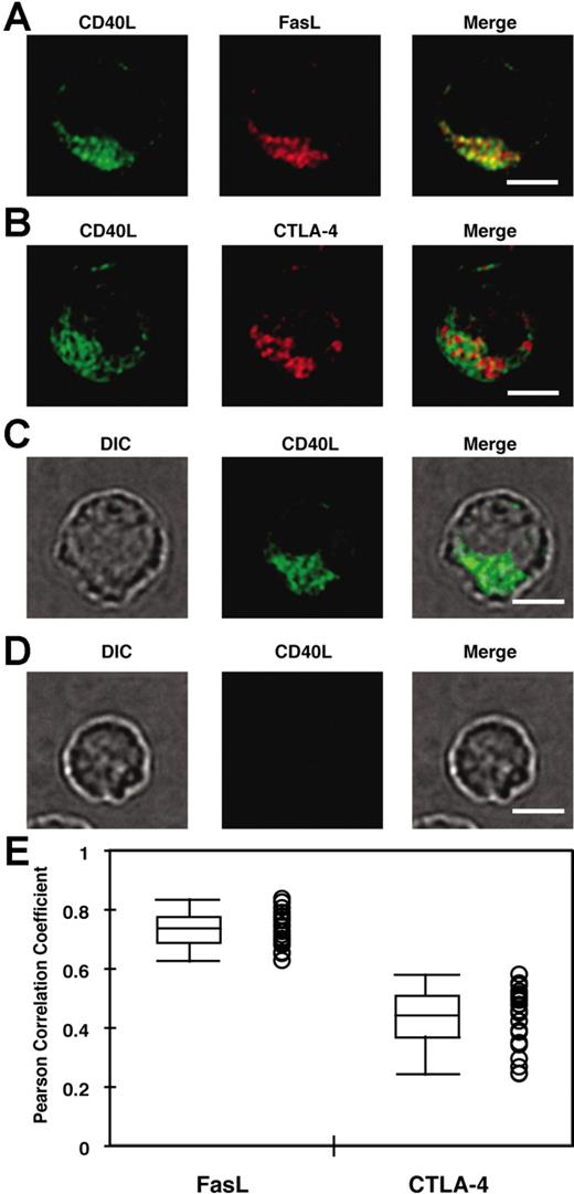 Figure 3. CD40L colocalizes more strongly with FasL than with CTLA-4. (A, B) In vitro–primed effector CD4+ T cells were used to analyze the degree of colocalization between CD40L and FasL (A) or CTLA-4 (B) as described in “Flow cytometric analysis of CD40L expression.” (C,D) The specificity of the polyclonal anti-CD40L Ab was tested with in vitro–primed effector CD4+ T cells from CD40L-sufficient (C) or -deficient (D) mice. DIC indicates differential interference contrast image. Scale bar equals 4 μm. (E) The Pearson correlation coefficient between CD40L and FasL or CTLA-4 was obtained as described in “Materials and methods, Fixed cell microscopy, data processing, and analysis of colocalization.” A total of 25 cells and 30 to 50 Z sections for each cell from 2 experiments were analyzed. Each circle represents data from a single cell. Median (bar in the box), interquartile ranges (boxes), and maximum and minimum (whiskers) are also shown. The Pearson correlation coefficient for CD40L-FasL is significantly higher than that for CD40L–CTLA-4 (P < .001; Wilcoxon rank-sum test).