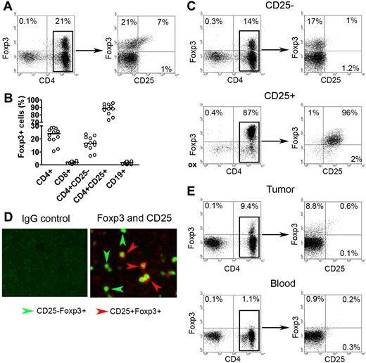 Figure 1. Foxp3 expression in CD4+CD25− T cells in biopsy specimens of B-cell NHL. (A) Representative dot plots showing Foxp3 expression in CD4+CD25+ and CD4+CD25− T cells in biopsy specimens of patients with NHL. Intracellular Foxp3 expression was determined by using fluorochrome-conjugated Foxp3 antibody. (B) Percentage of Foxp3 expression in different subsets of cells in NHL specimens (n = 12). The horizontal bars indicate median expression levels. (C) Representative dot plots showing Foxp3 expression in positive (CD25+) and negative (CD25−) fractions of CD25-depleted sample. (D) Representative immunofluorescence images showing Foxp3 expression in CD25+ and CD25− cells in biopsy specimens of patients with NHL. Tissues were stained with antibodies to human CD25 and Foxp3. Left panels shows isotype control for each antibody; right, double immunofluorescence staining of CD25 (red; surface) and Foxp3 (green; intracellular). Original magnification, × 200. See “Immunofluorescence assay” for image acquisition details. (E) Representative dot plots showing Foxp3 expression in CD4+CD25− T cells (CD25-depleted) from tumor tissue (top panel) and peripheral blood mononuclear cells (bottom panel) from patients with NHL. Percentages in panels A,C, and E represent number of cells in quadrant as a percentage of all cells.
