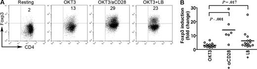 Figure 4. Effect of lymphoma B cells on activation-induced Foxp3 expression in CD4+CD25− T-cell biopsy specimens of B-cell NHL. (A) Purified CD4+CD25−CD127+ T cells were cultured in OKT3-coated plates (OKT3) or with the addition of anti-CD28 Ab (OKT3/aCD28) or CD19+ lymphoma cells (OKT3 + LB) for 3 days. Unstimulated cells (Resting) were used as the baseline for calculating Foxp3 induction. Foxp3 expression was examined by intracellular staining. Numbers indicate CD4+Foxp3+ cells as a percentage of all cells. (B) Summarization of Foxp3 induction in CD4+CD25− T cells upon activation with OKT3 alone (OKT3; n = 15) or plus anti-CD28 (+ aCD28; n = 6) or in the presence of lymphoma B cells (+ LB; n = 15). Foxp3 induction is indicated by fold change to group without stimulation (Resting). The horizontal bars indicate median.
