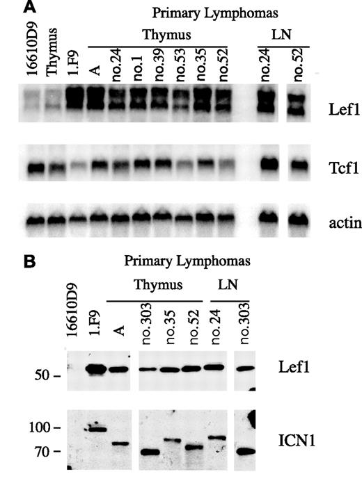 Figure 3. Expression of Lef1 in primary T-cell lymphomas. (A) Northern blot of RNA from primary lymphomas isolated from thymus or lymph nodes (LNs) of E2A−/− (A, and nos. 24, 1, 39) or E2A−/−Rag2−/− (nos. 53, 35, 52) mice compared with the E2A−/− lymphoma line 1.F9 or the p53−/− lymphoma line 16610D9. Probes specific for Lef1, Tcf1, and actin mRNA were used as indicated. Vertical lines have been inserted to indicate where a gel was cut. All lanes are from the same gel. (B) Western blot of primary lymphoma lines using Lef1 specific antibody (top panel). The same blot was subsequently probed with anti-Notch1 reactive with ICN1. ICN1 is a unique size in each lymphoma due to mutations resulting in truncation within the PEST domain. Vertical lines have been inserted to indicate where a gel was cut. All lanes are from the same gel.