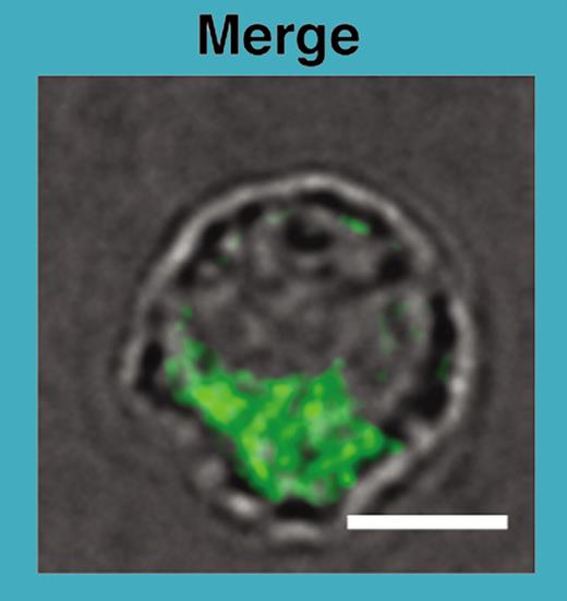 Preformed CD40L within secretory lysosomes in a murine CD4+ T cell (green fluorescence in this merged light-and-immunofluorescence micrograph) can be rapidly expressed on the cell surface after antigenic stimulation. See the complete figure in the article beginning on page 2520.