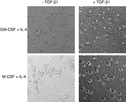 Figure 1. TGF-β1 induces a homogeneous DC morphology for M-DCs. CB monocytes were cultured with GM-CSF and IL-4 or M-CSF and IL-4 to generate GM-DCs and M-DC, respectively (left panels). TGF-β1 was added into GM-DC and M-DC cultures at the beginning of cell culture (right panels). Pictures were taken on day 5 of culture. Results are representative of more than 10 independent experiments. Cell morphology and photographs were observed and taken under a Zeiss Axiovert 25 inverted fluorescence light microscope (Carl Zeiss Microimaging, Thornwood, NY) with a CCD digital camera and computer for image analysis. Cell photographs were taken at a magnification of 400×.