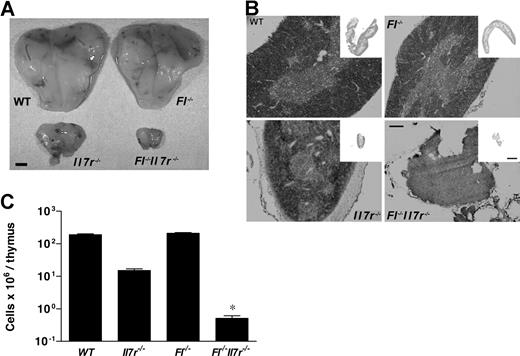 Figure 2. Impairment of thymic cellularity and architecture in adult mice double deficient in Fl and Il7r expression. (A) Typical thymuses from 8- to 10-week-old WT, Fl−/−, Il7r−/−, and Fl−/−Il7r−/− mice. Bar represents 0.5 mm. Photographs taken from Nikon SMZ-U dissection microscope (Melville, NY) with ED plan and 7.5-fold magnification using Sony Digital Hyper HAD color video camera (San Jose, CA) and MicroGraphix (Oxfordshire, United Kingdom) PhotoMagic software. Images were directly transferred to Microsoft PowerPoint (Redmond, WA) and adjusted for size. (B) Typical structure of thymuses from 8- to 10-week-old WT, Fl−/−, Il7r−/−, and Fl−/−Il7r−/− mice. Bar represents 0.5 mm. Images acquired with fluorescent microscope (Olympus BX51; Tokyo, Japan), with 10× and 20× objectives (Olympus UplanF1 10×/0.30 NA and 20×/0.50 NA, respectively) using Olympus DP70 camera and acquisition software (DP Controller; Olympus Optical, Tokyo, Japan) and analysis software (analySIS; Olympus Soft Imaging Solutions, Münster, Germany). (C) Total thymic cellularities from 8- to 10-week-old WT, Fl−/−, Il7r−/−, and Fl−/−Il7r−/− mice in log scale. Data represent mean (SD) values of 7 to 8 age-matched mice of each genotype. *P < .01 comparing Il7r−/− and Fl−/−Il7r−/− mice.