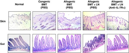 Figure 3. Histologic analysis of anti–IL-7Rα antibody-treated allogeneic recipients. Skin and small intestine tissues from the recipients were analyzed at day 30 following BMT. Representative tissue samples from each group of mice were stained with H&E. The skin and small intestine from the PBS-treated allogeneic BMT-plus-LN recipients showed evidence of GVHD with lymphocytic infiltration and inflammation. The tissue sections from anti–IL-7Rα antibody-treated allogeneic BMT-plus-LN recipients had normal histology. See “Materials and methods, Histologic analyses” for image acquisition information.
