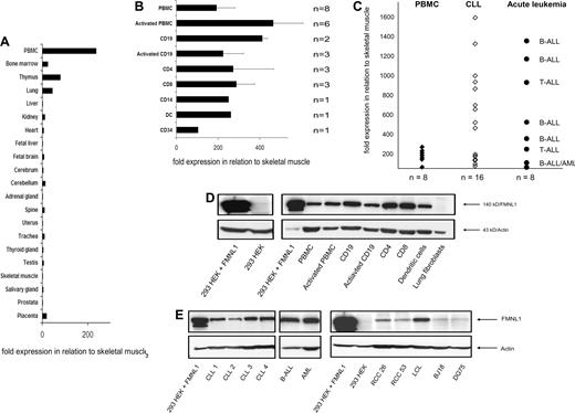 Figure 1. Expression of FMNL1 in normal and malignant tissue. (A) Relative quantitative mRNA expression of FMNL1 in different tissues pooled from different healthy donors was measured using quantitative real-time PCR. The relative quantitative expression compared with skeletal muscle was calculated using the delta-delta Ct method. (B) Relative quantitative mRNA expression of FMNL1 in stimulated PBMCs and PBMC-derived subpopulations is shown. Subpopulations were isolated by negative (CD4, CD8, CD14, CD19) and positive (CD34) magnetic bead depletion. Monocyte-derived dendritic cells (DCs) were isolated by adhesion, cultured in presence of IL-4 and GM-CSF, and matured with IL1β, IL-6, TNF-α, and prostaglandin E2. For activation of PBMCs, cells were incubated for 3 days using IL-2 and OKT3; B-cell activation was induced by incubation with CD40L-transfected NIH3T3 cells for at least 3 weeks. Error bars indicate the standard deviation of different samples tested. (C) Relative quantitative mRNA expression of FMNL1 in CLL samples and tumor cells derived from patients with acute B- and T-ALL as well as AML is shown in comparison with normal PBMCs. (D) FMNL1 protein expression in PBMC-derived cells, lung fibroblasts, and nontransfected 293 HEK cells by Western blot analysis. Total protein (50 μg) was used for sodium dodecyl sulfate–polyacrylamide gel electrophoresis (SDS-PAGE). 293 HEK cells transfected with FMNL1 were used as positive control. Probing with antiactin antibody served as loading control. (E) FMNL1 protein expression in native tumor cells and transformed cell lines by Western blot analysis. Total protein of native leukemic cells (50 μg) and total protein of lysed cell lines (100 μg) was used for SDS-PAGE. 293 HEK cells transfected with FMNL1 were used as positive control. Probing with antiactin antibody served as loading control.