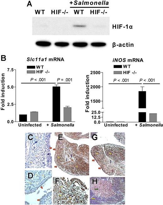 Figure 7. HIF-1α is functionally linked to prototypical SLC11A1-associated diseases. (A) S typhimurium infection up-regulates HIF-1α. Bone marrow–derived macrophages from wild-type (WT) or conditional HIF-1a-LysMcre (HIF−/−) mice were infected with Salmonella (multiplicity of infection = 10). HIF-1α expression was detected by Western blotting using β-actin expression as loading control. (B) Slc11a1 and iNOS are activated in Salmonella infection. Slc11a1 and iNOS expression was determined and compared in WT and HIF-1a-LysMcre mice by quantitative real-time RT-PCR; expression levels were normalized to 18S ribosomal RNA levels. Fold induction is with respect to uninfected controls; data represent averages of 4 replications (means ± SEM). (C-H) Association between HIF-1α and SLC11A1 in inflammatory disease. Immunohistochemical staining of control, nonarthritic tissue with antibodies to (C) HIF-1α or (D) SLC11A1 shows that neither protein is induced or expressed in the synovium, vessels, or lymphocytes. (E) RA tissue sections were immunolabeled with anti-SLC11A1 antibody; SLC11A1 expression was detected in synovial cells (red arrows), vessels (blue arrows), and infiltrating lymphocytes (yellow arrows). (F) A × 200 magnification of panel E to show infiltrating lymphocytes stained for SLC11A1. (G) HIF-1α shows a pattern of expression that is similar to SLC11A1 expression in RA tissue sections. (H) SLC11A1 reactivity was also detected in lymphocytes in reactive sinus histiocytosis (green arrow shows reactive lymph node) but not in a control lymph node (yellow arrow). All sections were counterstained with hematoxylin. Images were acquired with a Nikon Eclipse E400 microscope using 20×/0.75 NA (panels C, D, F, and H; magnification ×200) or 10×/0.45 NA objective lenses (panels E and G; magnification ×100); They were processed with Nikon ACT-1 software version 2 and assembled with Adobe Photoshop version 7.