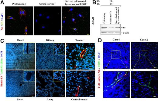 Figure 2. The distribution of cell-surface nucleolin in vitro and in vivo. (A) Colocalizations between ES (green) and NL (red) on HMECs with different growth states were detected by indirect immunofluorescence. DAPI (blue) indicates cells in the field. Scale bar represents 20 μm. (B) HMECs with different growth states were incubated with ES for 1 hour, and then applied to co-IP and IB with anti-NL and anti-ES antibody, respectively. Actin blot serves as loading control. (C) Biotinylated ES and the anti-NL antibody were simultaneously injected intravenously into mice bearing B16/F10 tumors. Biotinylated ES and nonimmune rabbit IgG were simultaneously injected intravenously as control tumor. After 1 hour, the distribution of biotinylated ES (red) and anti-NL antibody (green) in heart, liver, kidney, lung, tumor, and control tumor was detected with TRITC-conjugated streptavidin and FITC-conjugated goat anti-rabbit IgG, respectively. DAPI (blue) indicates cells in the field. Arrows indicate the blood vessels in the field. Inset boxes show the magnified photos of the blood vessels in normal tissues. Scale bar represents 50 μm in the sections of heart, liver, kidney, and lung, and 20 μm in the sections of tumor, control tumor, and inset boxes. (D) Variant expression levels of cell-surface-NL in 2 colorectal tumor cases. The sections of primary colorectal carcinomas were stained with anti-CD31 (green) and the cell-surface NL–specific antibody (red). Scale bar represents 50 μm. The magnified pictures were shown in lower panels of each case. Scale bar represents 20 μm.
