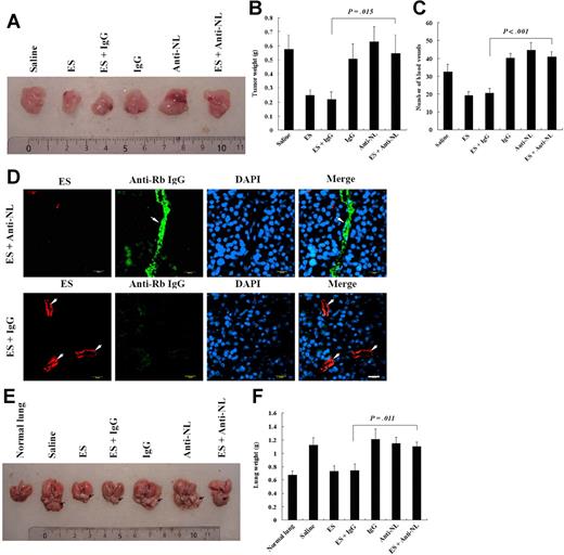 Figure 4. Nucleolin mediates the antitumor and antiangiogenic activities of endostatin. (A,B) Xenograft Hela carcinoma growth assay was performed as described in “Tumor growth assay, Hela xengraph mode.” Resected tumors were photographed (A), weighed (B, n = 5), sectioned, and applied to immunohistochemistry. Scale unit represents centimeters. (C) The blood vessels on tumor sections were stained with anti-CD31, and the numbers were counted (n = 5). (D) The tumors, which were treated with ES (2 mg/kg) along with the anti-NL antibody (2 mg/kg) and ES (2 mg/kg) along with nonimmune IgG (2 mg/kg), were applied to further immunohistochemical analysis. ES (red) and the rabbit IgG (the anti-NL or nonimmune IgG, green) were detected with murine anti-His-tag antibody followed by TRITC-conjugated goat anti-mouse IgG and FITC-conjugated goat anti-rabbit IgG, respectively. DAPI (blue) indicates cells in the field. Arrows indicate the blood vessels in the field. Scale bar represents 20 μm. (E,F) Orthotopic Lewis lung carcinoma growth assay was performed in parallel with that of xenograft Hela carcinoma. Resected LLC tumor along with lung were photographed (E), and weighed (F, n = 5). Arrows indicate the tumors. Scale unit represents centimeters. Error bars are SD.