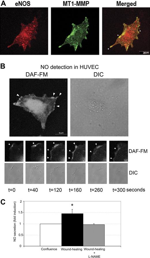Figure 1. eNOS is active at motility-associated structures of human endothelial cells, where it colocalizes with MT1-MMP. (A) Subcellular location of eNOS (red) and MT1-MMP (green) was analyzed by immunofluorescence double-staining of subconfluent HUVECs. The merged image reveals colocalization (yellow); arrows indicate colocalization at membrane protrusions. (B) Migrating HUVECs were preloaded for 30 minutes with the NO probe DAF-FM, and NO production was clearly visible at cellular protrusions (top). The lower figure shows representative real-time capture (n = 4) of DAF-FM fluorescence at the lamellipodia of a migrating EC. The location of NO production was recorded over 6 minutes at lamellipodia in migrating ECs at 20-second intervals; t = 0 indicates the beginning of recording. Note the appearance and disappearance of NO production at lamellipodia during the recorded period (bottom, arrowheads). (C) HUVECs were left untreated or treated with L-NAME for 1 hour. Migration was initiated by disrupting monolayers (“In situ detection and measurement of NO production”). NO production was measured as the accumulation of NO2- released into the culture medium over 30 minutes by resting (confluent) or migrating (wound-healing) HUVECs. The chart shows the arithmetic mean plus or minus the standard deviation (SD) of the fold induction (FI) over nitrite release from 3 independent experiments run in duplicate. The absolute value corresponding to FI = 1 was 307 nM. *P < .04.
