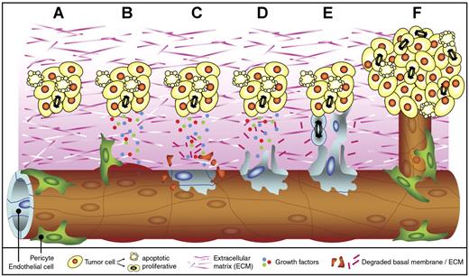 Figure 1. Tumor angiogenesis. Tumor angiogenesis is a multistep process that occurs in almost all tumors and that is mediated by endothelial cells (ECs). When a cell has acquired genetic alterations that allow unlimited growth and escape from apoptosis, a small tumor is formed (A). As soon as the tumor volume has reached a few cubic millimeters, oxygen and nutrient supply are insufficient, and the tumor cells undergo an angiogenesis switch. This results in the production and release of growth factors into the surrounding tissue. The secreted growth factors bind to receptors on ECs in nearby vessels. Pericytes that stabilize the vessel detach, and vessel dilation occurs (B). In addition, the activated ECs start to produce proteases (not shown) that degrade the basal membrane and the extracellular matrix (C). Subsequently, the ECs start to migrate (D) and proliferate (E) into the growth factor gradient, forming new vascular structures. Finally, matrix proteins are deposited, and the new vessel is stabilized by pericytes to form a functional and mature blood vessel. The tumor cells can continue to grow, and metastasis formation is facilitated since the tumor cells now have easy access to the circulation (F).