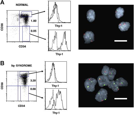 Figure 1. Thy-1 expression within CD34+CD38+ progenitor and CD34+CD38− stem cell compartments in normal and 5q− syndrome BM. CD34-enriched normal (A) and 5q− (B, patient no. 6) BM cells were stained with monoclonal antibodies (MAbs) against CD34, CD38, and Thy-1 or irrelevant isotype control Abs (“Purification of BM cell populations”). Left panels show expression profiles for already CD34-enriched cells, with the size of the CD34+CD38+ and CD34+CD38− populations given as percentages of total MNCs. Shown are also the gates for CD34+CD38+ and CD34+CD38− cells used for sorting and for further investigation of Thy-1 expression (middle panels). Dotted lines represent the negative isotype control and solid lines the specific Thy-1 expression. Note that Thy-1 expression is much higher in CD34+CD38− than in CD34+CD38+ cells for both healthy and 5q− subjects. Sorted CD34+CD38−Thy-1+ candidate HSCs and CD34+CD38+Thy-1− candidate progenitors were analyzed by FISH for the 5q deletion. Normal CD34+CD38−Thy-1+ cells (A) show 2 green and 2 red signals, whereas CD34+CD38−Thy-1+ cells with 5q deletion (B) show 2 green and 1 red signal (right panels). Bars in the FISH pictures represent 10 μm.
