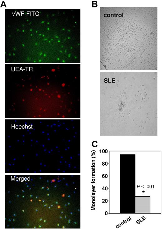 Figure 2. Lupus PBMCs fail to form mature EC monolayers. (A) Control PBMCs were plated into fibronectin-coated wells in complete EC media. On day 15, cells were stained with anti–VWF-FITC, UEA-1–Texas red, and Hoechst 33342 and analyzed by fluorescent microscopy. Images are from 1 representative healthy control and show single fluorophores and a merged image (bottom; × 20 objective magnification). (B) On day 15, wells were examined for EC monolayer development. Representative images of PBMC-derived cells from a healthy control and a lupus patient (× 5 objective magnification). See “In vitro differentiation into mature ECs” for more image acquisition information. (C) The y-axis represents the percentage of controls (13/14) or lupus patients (7/33) that formed an EC monolayer.