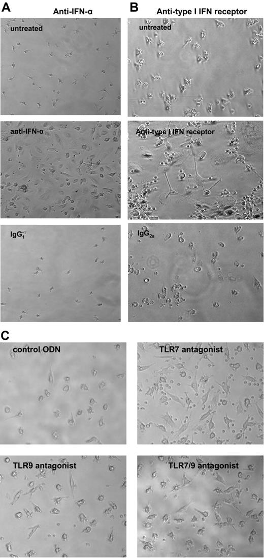 Figure 7. IFN-α blockade promotes EC monolayer formation in SLE. Lupus PBMCs were cultured under proangiogenic conditions in the presence or absence of (A) blocking antihuman IFN-α mAb or isotype control or (B) antihuman type I IFN-R or isotype control (all 2 μg/mL). At day 15, anti–IFN-α– or anti–type I IFN-R–treated cells, but not controls, formed EC monolayers. Results are representative of independent experiments in SLE patients who failed to form EC monolayers, which corrected with anti–IFN-α (n = 9) or with anti–type I IFN-R (n = 6). (C) TLR7 and/or TLR9 blockade promotes EC monolayer formation in SLE. Lupus PBMCs were cultured in EGM20 supplemented with a control ODN, a TLR7 antagonist, a TLR9 antagonist, or a TLR7/9 antagonist (1 μM). Images were acquired after 15 days in culture. Results show cells from a representative SLE patient. All magnifications are × 20. See “In vitro differentiation into mature ECs” for more image acquisition information.