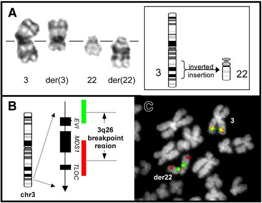 Figure 1. G-band and FISH analysis of an ins(22;3) in Ph− cells of a CML patient undergoing dasatinib treatment (patient 3). (A) Partial G-band karyotype showing the products of the ins(22;3)(q11;q26q21) (right) beside the normal chromosome homologues (left). Part of the q-arm of chromosome 3 is seen, inverted, within the structure of the abnormal chromosome 22. A simplified diagrammatic representation of the structural rearrangement resulting in this abnormality is shown (inset). (B) Structure of the EVI1 locus together with the composition and relative coverage of the dual-color EVI1 FISH probe (Kreatech Biotechnology, Amsterdam, The Netherlands). The probe system employs 2 separate components specific for the 5′ and 3′ portions of the locus, labeled in red and green, respectively. In cells without a 3q26 rearrangement, 2 red/green fusion signals are produced. In contrast, physical separation of 5′ and 3′ hybridization signals, or splitting of 1 of these component signals, is visible in cells with rearrangement of this region. (C) Analysis of an ins(22;3)–positive bone marrow metaphase cell from patient 3 using the dual-color EVI1 probe. One intact red/green fusion signal is observed on the normal chromosome 3 homologue, marking the unrearranged EVI1 locus. In contrast, the second EVI1 hybridization signal reveals relocation and rearrangement of this region, with part of the red 5′ signal hybridized toward the distal end of the der(22), whereas the remains of the red 5′ signal together with the green 3′ signal are present toward the centromere of this marker. This finding is consistent with an inversion of chromosome 3 involving a break distal to EVI1 and a subsequent insertion of 3q material, including the inverted region, into chromosome 22.