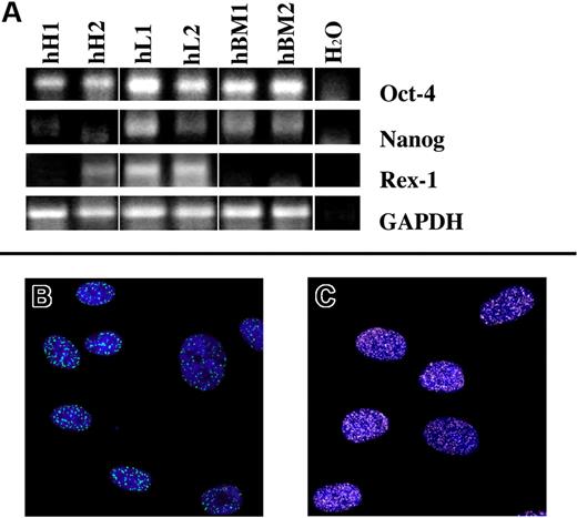 Figure 2. Pluripotent state–specific transcription factor (Oct-4, NANOG, and REX-1) expression. (A) Human heart-derived (hH1 and hH2), liver-derived (hL1 and hL2) and bone marrow–derived (hBM1 and hBM2) cells express, at mRNA level, at least 2 of the tested markers. Green dots (A488; B), and white dots (A488; C) represent the nuclear expression of oct-4 and nanog proteins, respectively. Nuclei are depicted by the blue fluorescence of DAPI staining. Image acquisition was carried out by a Confocal Laser Microscope (Leica TCS-SP2; Leica Microsystems, Milano, Italy), using a 63 × oil immersion objective (numeric aperture: 1.40). Adobe Photoshop software was used to combine RGB channels, overlay the images, and adjust contrast (Adobe, San Jose, CA).