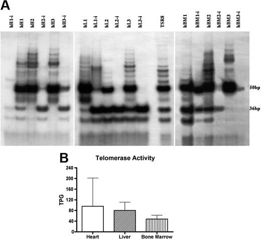 Figure 3. Telomeric repeat amplification protocol (TRAP) assay. (A) Telomerase activity products of human heart-derived (hH1, hH2, and hH3), liver-derived (hL1, hL2, and hL3), and bone marrow–derived (hBM1, hBM2, and hBM3) multipotent cells display 6-bp periodicity. Cells treated with RNase (-i) were used as negative control. TSR8 lane represents the telomerase quantitation control template. Developed autoradiographic film was acquired by SnapScan 1236 (Agfa, Mortsel, Belgium) connected to a Macintosh G3 Computer (Apple, Cupertino, CA) equipped with ScanWise software (v1.2.1; Agfa). (B) Quantitation of multipotent cell line telomerase activity. Each unit of total product generated (TPG) corresponds to the number of TS primers (in 1 × 10−3 amole or 600 molecules) extended with at least 4 telomeric repeats by telomerase. Results are presented as mean and standard deviation. The differences among cell lines did not reach statistical significance.