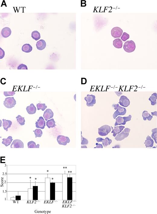 Figure 3. Morphology of WT, KLF2−/−, EKLF−/−, and EKLF−/−KLF2−/− E9.5 circulating blood cells. The total number of embryo samples examined for each genotype is indicated in the Figure 4 legend. (A-D) Representative cytospins of Giemsa-stained primitive erythroid cells. Cytospins were prepared from blood samples collected from E9.5 yolk sacs and embryos. (A) Wild-type. (B) KLF2−/−. (C) EKLF−/−. (D) EKLF−/−KLF2−/−. Photographs were taken at 1000 × magnification. See “Analysis of EKLF−/−KLF2−/− embryos” for more image information. (E) Semiquantitative assessment of abnormal cytoplasmic and nuclear morphology in WT, KLF2−/−, EKLF−/−, and EKLF−/−KLF2−/− cytospins. Ten primitive blood cells from each sample were scored from 1 to 3, based on severity of cytoplasmic pleiomorphism and nuclear atypia (white and black bars, respectively). A score of 1 indicates the most normal, and of 3 the most abnormal morphology. Error bars indicate standard deviation from the mean. For WT, EKLF−/− and EKLF−/−KLF2−/−, n = 40 cells, and for KLF2−/− samples, n = 20. * indicates a significant difference from WT at P < .001, and ** is significantly different from WT, KLF2−/−, and EKLF−/− at P < .001 using Student t test of comparison of means.