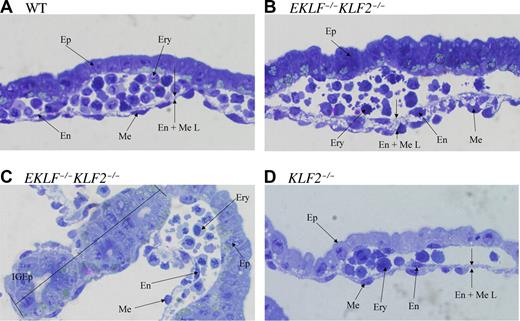 Figure 5. E9.5 EKLF−/−KLF2−/− yolk sac blood islands have abnormal morphology. Panel A is a representative section from a wild type, panels B and C are from 2 different EKLF/KLF2 double knockout, and panel D is from a KLF2−/− embryonic yolk sac. The abbreviations used are columnar epithelium (Ep), erythroid cells (Ery), endothelial cells (En), mesothelial cells (Me), endothelial/mesothelial layer (En + Me L), and ingrowth of epithelial cells (IGEp). Photographs were taken at 400 × magnification. See “Analysis of EKLF−/−KLF2−/− embryos” for more image information.