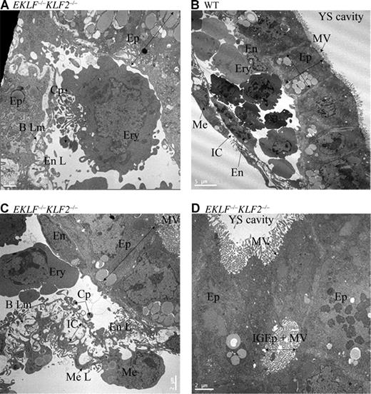 Figure 6. Electron micrographs of E9.5 yolk sac cells. (A) Representative erythroid cell from EKLF/KLF2 double knockout. (B) Wild-type and (C) EKLF/KLF2 double-knockout sections indicating the cell types in the yolk sac. (D) Abnormal ingrowth of microvilli in epithelial cells in EKLF/KLF2 double knockout. The abbreviations used are erythroid cells (Ery), cytoplasmic projections (CP), mesothelial cells (Me), intercellular space (IC) between the mesothelial (Me L) and endothelial layers (En L), basal lamina (B Lm), microvilli (MV), and ingrowth of epithelial cells (IGEp). Scale is shown in each photograph. See “Analysis of EKLF−/−KLF2−/− embryos” for more image information.