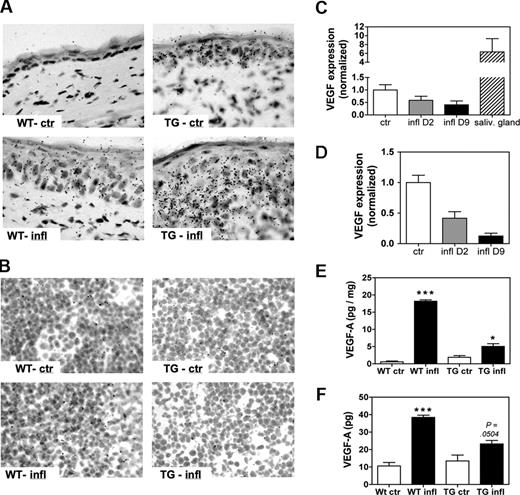 Figure 5. VEGF-A is expressed in the inflamed ears but not in the draining LNs. A DTH response was induced and maintained in the ears of WT or of VEGF-A Tg mice, and VEGF-A mRNA and protein levels in ears and draining auricular LN were determined on study days 2 and 9. (A) In situ hybridization on study day 9 revealed that VEGF-A mRNA was up-regulated in inflamed ears of both WT mice (WT-infl) and of VEGF-A Tg (TG-infl) mice compared with WT and VEGF-A Tg control mice (WT-ctr and TG-ctr, respectively). (B) Virtually no VEGF-A mRNA expression was detected in LN sections from inflamed or control VEGF-A Tg (TG-infl and TG-ctr) and WT mice (WT-infl and WT-ctr). (C,D) Quantitative RT-PCR was performed on RNA extracted from auricular LNs of WT (C) or of VEGF-A Tg (D) mice. No increase in VEGF-A mRNA expression in inflamed over control LNs could be detected, neither when analyzing RNA extracted on study day 2 (D2) nor on study day 9 (D9). VEGF-A mRNA levels in salivary glands were assayed as positive control. (E,F) A VEGF-A ELISA was performed on tissue homogenates of ears (E) and draining LNs (F) on study day 9. (E) VEGF-A protein concentration was significantly elevated in homogenates of inflamed ears, compared with controls. (F) The amount of VEGF-A protein was significantly higher in homogenates from inflamed LNs compared with control LNs. *P < .05; ***P < .001 (compared with control). Error bars are SE.