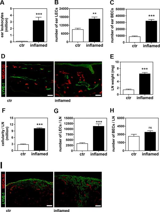 Figure 6. Lymphangiogenesis in LNs that drain inflamed ears occurs in the absence of nodal B cells. A DTH response to oxazolone was induced in the ears of B cell-deficient JHT mice and maintained by repeatedly challenging the ears of the mice with oxazolone over 9 days. Ears and draining auricular LNs were analyzed on study day 9. (A-C) Quantitative FACS analysis detected a significant increase in the numbers of leukocytes (A) and of LECs (B) and BECs (C) in cell suspensions of inflamed compared with control (ctr) ears. (D) Immunofluorescence analysis of LYVE-1 (green) and MECA-32 (red) expression confirmed that vascularization was increased in inflamed compared with control ears. Scale bars represent 50 μm. (E,F) Analysis of ear draining auricular LNs revealed that LN weight (E) and cellularity (F) was significantly increased in LNs of inflamed animals compared with LNs of control animals. (G,H) Quantitative FACS analysis detected elevated numbers of LECs (G) in LNs draining inflamed compared with LNs draining control ears, but no change in BEC numbers (H). (I) Immunofluorescence analysis of LYVE-1 (green) and MECA-32 (red) expression confirmed that lymphatic structures were markedly expanded in LNs draining inflamed compared with control ears. Scale bars represent 100 μm. **P < .01; ***P < .001 (compared with control). Error bars are SE.