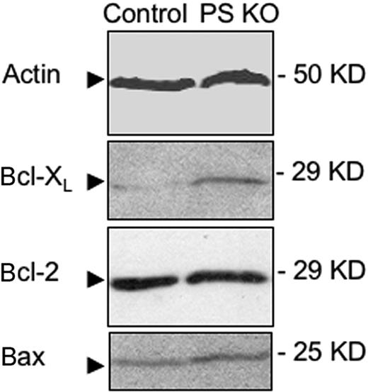 Figure 3. Thymocytes from PS KO animals express more Bcl-XL than thymocytes from control animals, without changing the expression of Bcl-2 or Bax. Protein extracts were obtained from thymocytes of control or PS KO animals, and expression of actin, Bcl-2, Bcl-XL, and Bax was visualized by Western blot (WB).