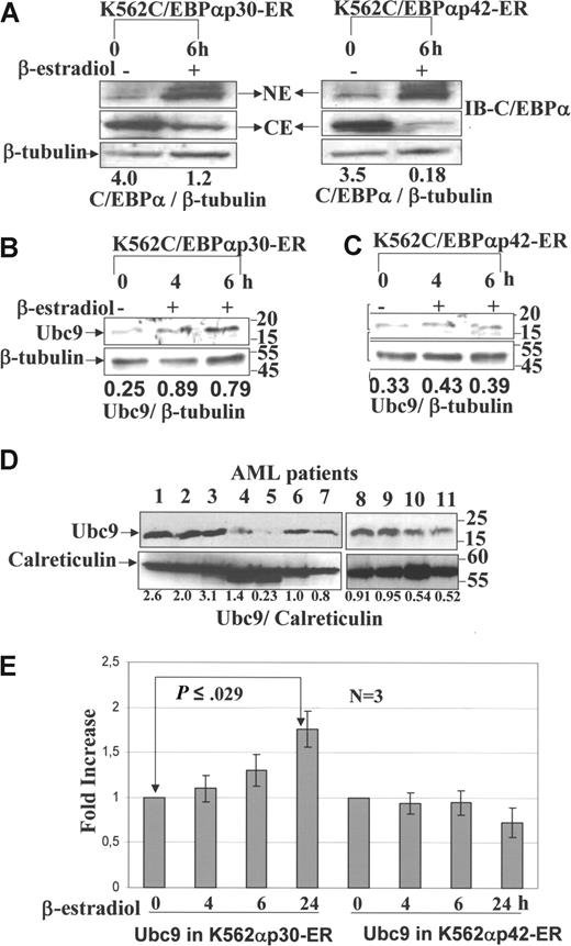 Figure 2. Validation of Ubc9 expression by Western blot and quantitative RT-PCR. Western blot analysis was performed from nuclear extract and cytoplasm extract of K562C/EBPαp30-ER and p42 cell line after β-estradiol induction at different time points using anti-C/EBPα antibody. Western blot analysis was also performed from whole-cell lysates of AML patient cells, K562 C/EBPαp30-ER cells, and C/EBPαp42-ER cells before and after β-estradiol induction at different time points using anti-Ubc9 antibody. (A) Nuclear translocation is induced by treatment with β-estradiol. (B,C) Ubc9 expression in K562C/EBPαp30-ER and K562C/EBPαp42-ER cells after β-estradiol induction. (D) Patients with AML with different subtypes (lanes 1-3, 8, and 9: patients with AML with C/EBPαp30 mutation; lanes 4 and 10: t(8;21); lane 5: Inv(6); lanes 6 and 11: Inv3; and lane 7: normal bone marrow). The numbers underneath the blot are the densitometric values calculated as protein–β-tubulin ratios using ImageJ 1.36 software (National Institutes of Health, Bethesda, MD). (E) Quantitative real-time PCR for the expression of Ubc9 mRNA after β-estradiol induction at different time points. The fold increase for expression was calculated using Δct = (Ct sample − Ct control), and ΔCt values for each sample were standardized by GAPDH Ct value. The fold change was calculated as (= 2−Δct). Values are expressed as means (± SEM) for 3 independent experiments, with P values shown on histograms.