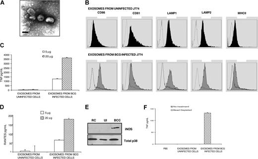 Figure 1. Activity and characterization of exosomes isolated from uninfected and M bovis BCG–infected J774 cells. (A) Morphologic characterization of exosomes by transmission EM. Representative EM of a sucrose gradient purified exosome (magnification, × 100 000; scale bar = 100 nm). Images were acquired with Microtek Scan Wizard 5 (Microtek Lab, Carson, CA). (B) Surface phenotype of exosomes by flow cytometry. Sulfate/aldehyde latex beads coated with indicated exosome preparations were probed for CD86, CD81, LAMP1, LAMP2, and MHC class II, and the mean fluorescence intensity (MFI) shown (filled peaks). Open peaks represent background MFI of exosome-coated beads probed with isotype control mAb. Data are the representative of 2 separate experiments. Exosomes derived from uninfected or M bovis BCG–infected J774 cells were added to BALB/c BMMs and TNF-α (C) or RANTES (D) production was evaluated 24 hours after exosome treatment by ELISA. (E) BALB/c BMMs were treated with 10 μg of exosomes isolated from uninfected or M bovis BCG–infected J774 cells. Western blot analyses were performed on macrophage cell lysates obtained 24 hours after exosome treatment using antibodies specific for iNOS. Total p38 was used as a loading control. Results are representative of 2 separate experiments. (F) BALB/c BMMs were incubated with the exosome-containing or exosome-depleted material from the sucrose gradient. TNF-α levels were measured by ELISA 24 hours after exosome treatment. ELISA data are representative of 2 independent experiments and are expressed as means plus or minus standard deviation of duplicate wells. RC indicates resting cells; and UI, exosomes from uninfected J774 cells.