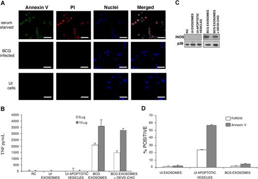 Figure 2. Exosomes, not apoptotic vesicles, are responsible for the proinflammatory activity. (A) J774 cells were infected with M bovis BCG for 4 hours. As controls, macrophages were left uninfected or were starved of serum to induce apoptosis. Macrophages were treated with annexin V (green) and propidium iodide (red), fixed, and analyzed by confocal microscopy. Nuclei were stained using the bisalkylamino-anthraquinone fluorphore Draq5. Fluorescent images are representative of 2 independent experiments (scale bar = 10 μm). Images were acquired with a Nikon Diaphot 200 (Nikon, Tokyo, Japan), equipped with a 60× oil plan Apo160/0.17 NA lens with BioRad LaserSharp 2000 software (BioRad, Hercules, CA). (B) Exosomes were prepared from J774 cells infected with M bovis BCG treated with 50 μM of the caspase-3 inhibitor Ac-DEVD-CHO, or left untreated. As a control, apoptotic vesicles were also purified from serum-deprived J774 cells. Exosomes or apoptotic vesicles were added to separate, uninfected J774 cells; 24 hours after treatment, cell-conditioned media were assayed for TNF-α by ELISA. Data are representative of 2 independent experiments and are expressed as means plus or minus standard deviation for duplicate wells. (C) Cell lysates obtained 24 hours after treatment with exosomes or apoptotic vesicles were analyzed for iNOS expression by Western blot. Total p38 was used as a loading control. The results are representative of 2 separate experiments. (D) Sulfate/aldehyde latex beads coated with exosomes or apoptotic vesicles were probed by flow cytometry for annexin V binding or FcRII/III, and the percentage of beads positive for the markers is shown. Results are representative of 2 independent experiments and are exposed as means plus or minus standard deviation for duplicate wells. UI indicates uninfected J774 cells; BCG, J774 cells infected with M bovis BCG.