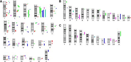 Figure 1. Genomic ideogram showing the distribution of LOH in low-risk MDS patients detected using the 250K SNP assay. Chromosome numbers are below each ideogram. (A) Distribution of UPD greater than 2Mb is shown. One hundred twenty-five regions of UPD were detected: red 5q− Syndrome (n = 33 regions); green RA+RCMDnc (n = 46 regions); blue RARS+RCMD-RS (n = 34 regions); pink RCMDac (n = 10 regions); and green RAEB (n = 2 regions). (B,C) Regions of deletions (del) and amplifications (amp) are shown. CN changes detected: red 5q− syndrome (del, n = 1 region); green RA+RCMDnc (del, n = 7 regions; amp, n = 7 regions); blue RARS+RCMD-RS (del, n = 5 regions; amp, n = 1 region); pink RCMDac (del, n = 5 regions; amp, n = 6 regions); and green RAEB (del, n = 1 region; amp, n = 1 region).