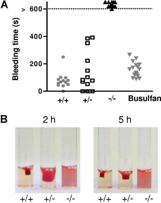 Figure 3. Bleeding time and clot retraction. (A) MYH9Δ mice had an increased bleeding time. Points indicate the time required for the arrest of bleeding, and when necessary bleeding was stopped manually after 10 minutes (control wt mice, , n = 13; heterozygous mice, □, n = 14; MYH9Δ mice, ▾, n = 21; wt mice treated with busulfan to achieve thrombocytopenia comparable to that of MYH9Δ mice, , n = 20). (B) Clot retraction was totally abolished in PRP from MYH9Δ mice, whereas it was delayed in heterozygous mice. The photograph corresponds to a 2- and 5-hour reaction in cPRP adjusted to 300 × 109 platelets/L and treated with 10 U/mL thrombin and is representative of 3 experiments.