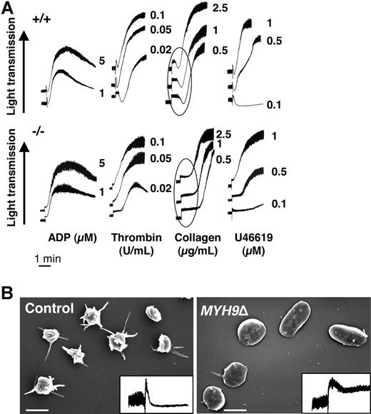 Figure 4. Platelet aggregation is preserved in MYH9Δ mice despite absence of initial shape change. (A) Platelet aggregation in response to ADP, thrombin, collagen, and U46619 was barely impaired in MYH9Δ mice (numbers correspond to the concentration of agonist). The initial platelet contraction responsible for a transient decrease in light transmission (circled) was absent in MYH9Δ platelets. Tracings are representative of at least 3 experiments. (B) Shape change was evaluated in the aggregometer after stimulation of washed platelets with 5 μM ADP in the absence of fibrinogen and the presence of eptifibatid. Shape change was visualized by scanning electron microscopy and by the decrease in light transmission (inset), representative of 3 independent experiments (bars 2 μm).