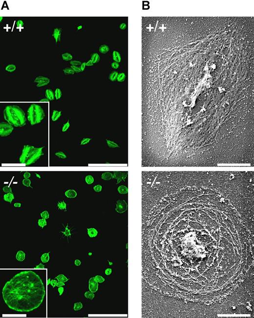Figure 5. Defective stress-fiber formation during spreading of MYH9Δ platelets. Platelets were pretreated with thrombin (1 U/mL) and allowed to adhere to fibrinogen-coated coverslips for 45 minutes. Actin filaments were visualized (A) by confocal fluorescence microscopy after phalloidin-AF 488 labeling (bars 25 μm, inset 7.5 μm) and (B) by SEM after Triton X100 permeabilization (bars 2 μm). Representative of 3 experiments.