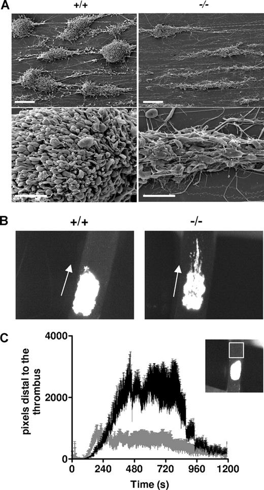 Figure 7. Defective thrombus formation in vitro and in vivo. (A) Whole blood from busulfan-treated wt mice (+/+) or MYH9Δ mice (−/−) was anticoagulated with hirudin (100 U/mL) and perfused through collagen-coated glass capillaries at a shear rate of 3000 s−1. Scanning electron microscopy imaging was performed after 2-minute perfusion and images are representative of 3 experiments. Bars, 20 μm (top panels) and 5 μm (bottom panels). (B) FeCl3-induced injury was performed in the carotid of busulfan-treated wt mice (+/+) or MYH9Δ mice (−/−) and the thrombus growth was video recorded. Images are representative of 8 mice, at time 600 seconds following injury (original magnification × 45). (C) Time courses of the embolus surface area measured by the fluorescence passing through the region of interest (white square in the insert), downstream of the thrombus. Busulfan-treated wt mice (gray curve) and MYH9Δ mice (black curve); n = 8, P < .001 (Student paired t test).