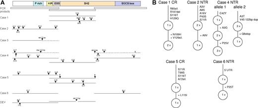 Figure 2. Schematic presentation of SOCS1 mutations in L&H cells. The complete coding region of SOCS1 was amplified and sequenced from genomic DNA of single micromanipulated L&H cells of 12 cases and the lpHL-derived cell line DEV. (A) A scheme of the SOCS1 protein with functionally important regions and the 3 PCR fragments amplified are shown at top (P rich indicates proline rich; KIR, kinase inhibitory region; and ESS, extended SH2 domain). For each case with mutations in SOCS1, only regions and alleles that carried mutations are presented. Mutations are indicated by ▴. The deletion in case 3 is of germ-line origin. Protein sequences translated out of frame due to deletions or duplications are shown in − − − and stop codons, by †. In addition to the mutated alleles, unmutated alleles were amplified for the central region (CR) of case 1 (7×), the N-terminal region (NTR) of case 2 (3×), the NTR of case 3 (1×), the CR of case 4 (1×), the NTR and CR of case 5 (1× and 2×), and the NTR and C-terminal region (CTR) of case 6 (2× and 3×). Amplification of only 1 unmutated allele for a fragment of a case (NTR of case 3, CR of case 4, and NTR of case 5) is most likely due to cellular contamination during micromanipulation. Apart from the replacement mutations shown, altogether 7 silent mutations were observed (not shown; see Table S2 for details). For alleles with ongoing somatic mutation, the variant carrying the most mutations is always presented. (B) Stepwise accumulation of mutations for alleles with intraclonal diversity is shown. Presence of truncating and replacement mutations in functional important regions of SOCS1 suggest that SOCS1 function is impaired in L&H cells.