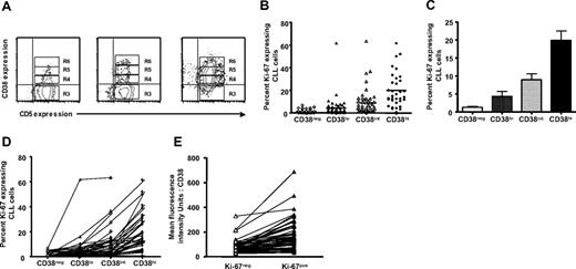 Figure 3. Ki-67 expression in relation to density of CD38. PBMCs from patients with CLL were stained as described for Figure 1, and contour plots depicting expression of CD5 and CD38 in CD19+ cells of patients with CLL were generated. (A) The CD38+ fraction was divided into 3 regions—R4, R5, and R6—referred to as CD38low, CD38int, and CD38high, respectively. Percentages of Ki-67–expressing cells were scored only if at least 50 cells fell within marked regions. (B) Percentages of Ki-67–expressing cells in CD38low, CD38int, and CD38high subsets from 60 of 95 patients with CLL. Horizontal lines indicate averages of values in corresponding populations. (C) Average (± SE) of values from panel B. (D) Lines connect data points depicting percent Ki-67+ cells in each CD38 subset for each of 60 patients with CLL. (E) In every patient studied, CD5+Ki-67+ cells showed higher density of CD38 compared with CD5+Ki-67− cells from the same case.