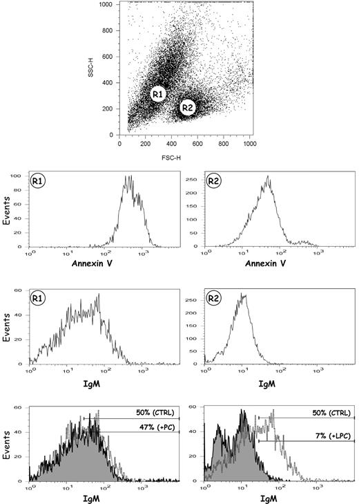 Figure 5. Binding of carbonate-released exosomal IgM to apoptotic cells. Apoptosis was induced in Jurkat cells by treatment with an anti-FAS antibody (CD95) for 16 hours. Cells were then incubated with dialyzed carbonate wash from exosomes. After washing, cells were analyzed by flow cytometry for the presence of IgM. (Top panel) Dot plot (FCS vs SSC) defining 2 regions, R1 and R2, corresponding to apoptotic and nonapoptotic cells, respectively. (R1 and R2 panels) The 2 regions were analyzed for annexin V and IgM binding. (Bottom panels) IgM binding to apoptotic cells was carried out after preincubation of the carbonate wash to microplates coated with phosphatidylcholine (+PC; tinted pattern) or lysophosphatidylcholine (+LPC; tinted pattern) to deplete specific natural IgM antibodies. CTRL (–) carbonate wash was directly incubated with cells.