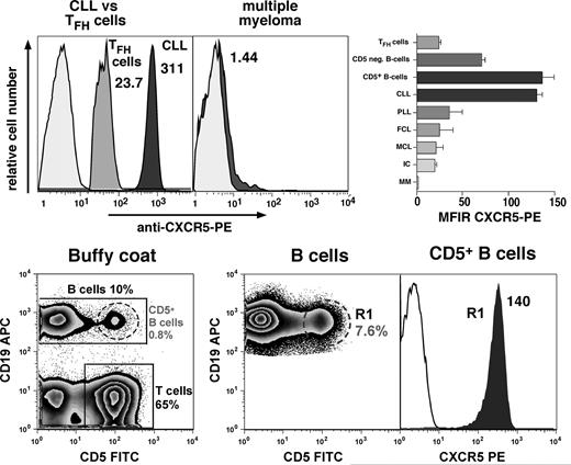 Figure 1. High-level CXCR5 surface expression on CLL cells and normal CD5+ B cells. The top panel displays overlay histograms that depict the relative red fluorescence intensity after staining of CLL B cells, CXCR5-positive T cells (TFH cells), or neoplastic B cells from a patient with multiple myeloma with PE-labeled anti-CXCR5 mAbs (dark-gray histograms) or PE-conjugated isotype controls (light-gray histograms). CLL cells were identified by gating on the CD19-expressing cells, TFH cells by gating on the CD5+ and CXCR5-positive and CD19− lymphocytes, whereas multiple myeloma cells were gated by costaining with anti-CD38 and anti-CD138 mAbs. The CXCR5 mean fluorescence intensity ratio (MFIR) values are displayed next to each CXCR5 histogram. Compared with other B-cell neoplasias, TFH cells, or CD5− B cells, CLL B cells and normal CD5+ B cells consistently expressed higher levels of surface CXCR5, and multiple myeloma cells did not express surface CXCR5. The right-hand side box in the top panel displays a bar diagram that depicts the mean (± SEM) CXCR5 MFIRs for TFH cells (n = 3), normal CD5− B cells (n = 11), normal CD5+ B cells (n = 3), CLL B cells (n = 49), prolymphocytic leukemia cells (PLL, n = 3), follicular lymphoma cells (FCL, n = 2), mantle cell lymphoma cells (MCL, n = 2), immunocytoma (IC, n = 1), and multiple myeloma (MM, n = 3). The bottom panel displays contour plots that depict the staining and gating of buffy coat cells to determine CXCR5 expression on normal CD5+ B cells. A small proportion of circulating B cells coexpresses CD19 and CD5; this specimen had 10% CD19+ B cells, 0.8% CD19+/CD5+ B cells, and 65% CD5+ T cells, as indicated in the bottom left contour plot. Because of the low frequency of CD5+ B cells, we acquired 500 000 or more CD19+ B cells, which in this case contained 7.6% CD5+ B cells (middle contour plot). This allows us to determine CXCR5 expression levels on a sufficient number of CD19+/CD5+ B cells in gate R1. The right-hand histogram overlay displays the CXCR5 expression on CD5+ B cells in R1 (gray histogram), compared with the respective isotype control (white histogram), and the CXCR5 MFIR is displayed next to the CXCR5 histogram.