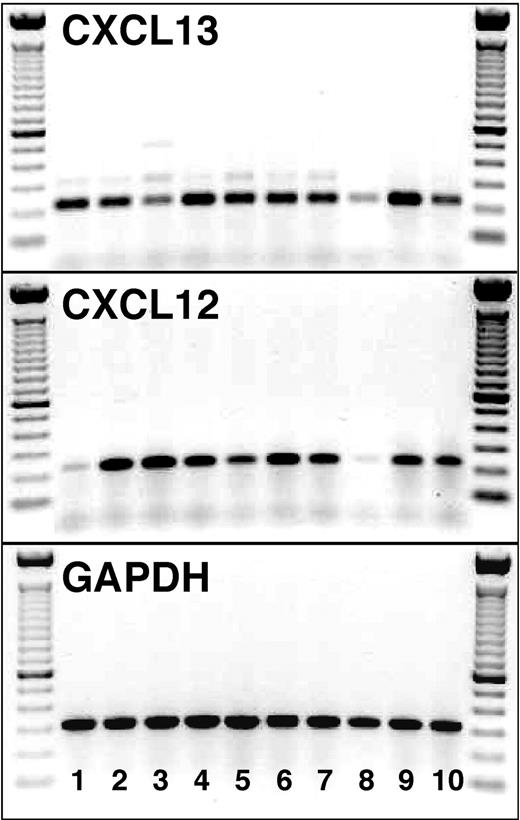 Figure 7. CXCL13 and CXCL12 mRNA expression by NLCs. cDNA from purified NLCs from 10 patients with CLL (lanes 1-10) was examined for the expression of CXCL13 (top box) and CXCL12 (middle box) mRNA by RT-PCR. The specific PCR fragments (225 bp for CXCL13 and 233 bp for CXCL12) are visible in each of the 10 NLC samples. The bottom box displays PCR fragments of the expected size using GAPDH primers for the same NLC samples. On the left- and right-hand side of each of the boxes, the separation of the 100-bp marker DNA is displayed.