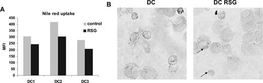 Figure 3. Modified lipid metabolism in PPARγ-instructed DCs. (A) Nile red uptake of control or PPARγ ligand (RSG)–treated DCs (5 days). Cells were stained with Nile red as described in “Nile red staining” for detection of lipid droplets. (B) Osmium tetroxide staining of DCs. DCs were cultured for 24 hours and control or RSG-treated cells were stained with osmium tetroxide. The arrows indicate the intracellular lipid droplets. See “Lipid body staining” for image acquisition information.